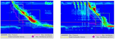 Dysmotility in Eosinophilic Esophagitis